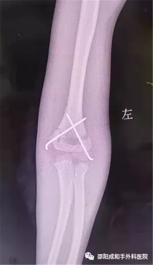 邵陽(yáng)市水利水電建設(shè)有限公司,邵陽(yáng)水利水電,邵陽(yáng)水利水電工程,邵陽(yáng)水利 邵陽(yáng)市水利水電建設(shè)有限公司,邵陽(yáng)水利水電,邵陽(yáng)水利水電工程,邵陽(yáng)水利