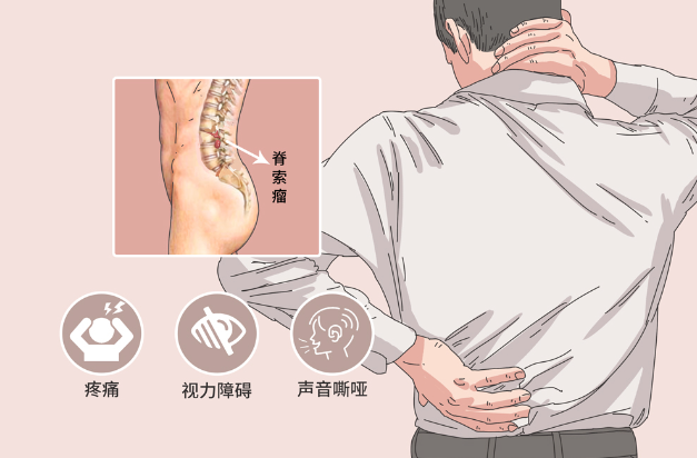 邵陽創(chuàng)傷骨科,邵陽風濕病區(qū),邵陽骨質增生,邵陽關節(jié)病區(qū),邵陽頸椎病區(qū)