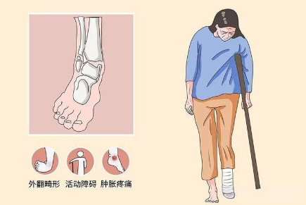 邵陽創(chuàng)傷骨科,邵陽風濕病區(qū),邵陽骨質(zhì)增生,邵陽關(guān)節(jié)病區(qū),邵陽頸椎病區(qū)